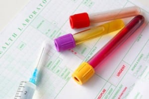 comprehensive metabolic panel