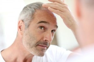 hair loss blood testing