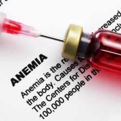 Anemia Facts - Are you anemic?
