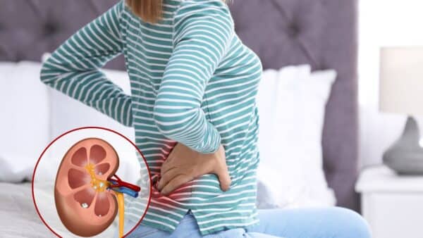 Do you understand kidney health?