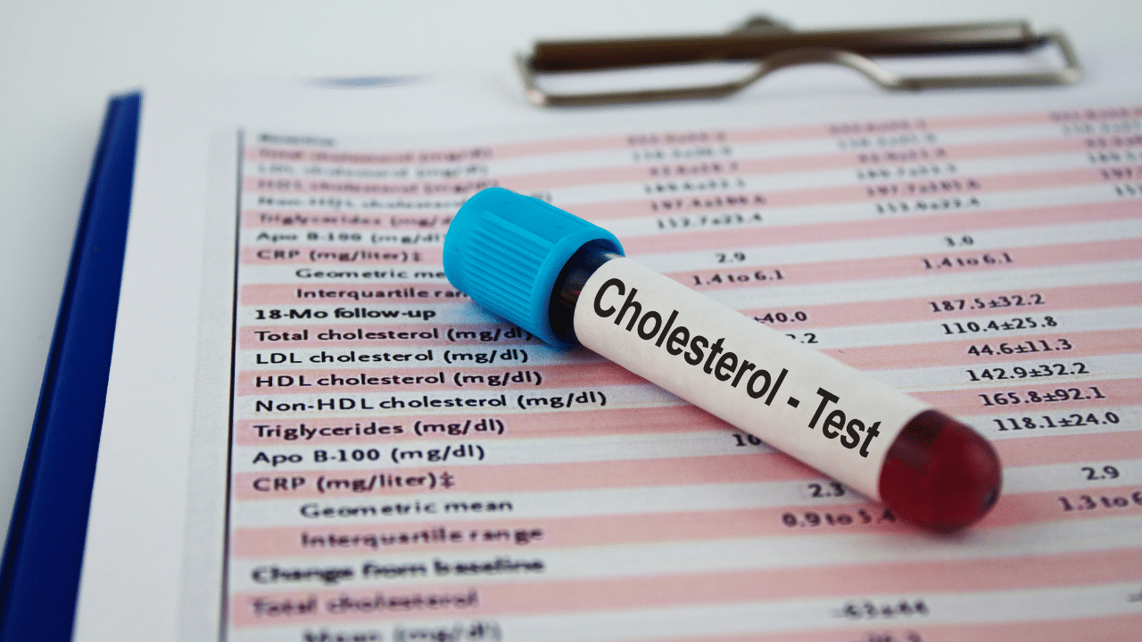 How Long to Fast Before a Cholesterol Test